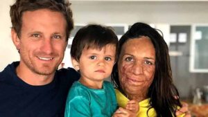 malgre-ses-horribles-brulures-au-niveau-du-visage-turia-pitt-a-toujours-ete-soutenue-et-aimee-par-son-conjoint